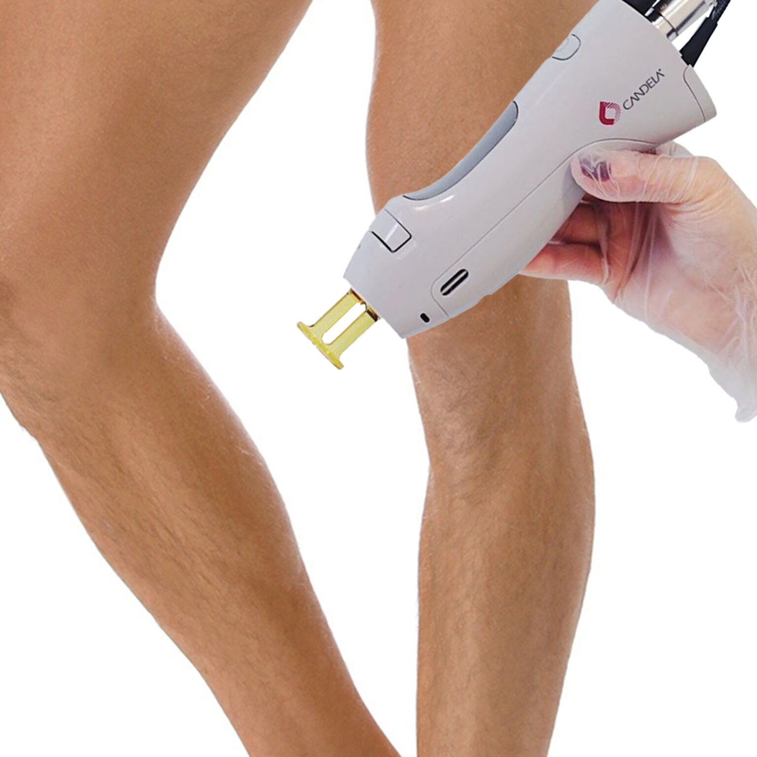 Laser Hair Removal Men On The Shins Price laser-hair-removal-men-on-the-shins-price